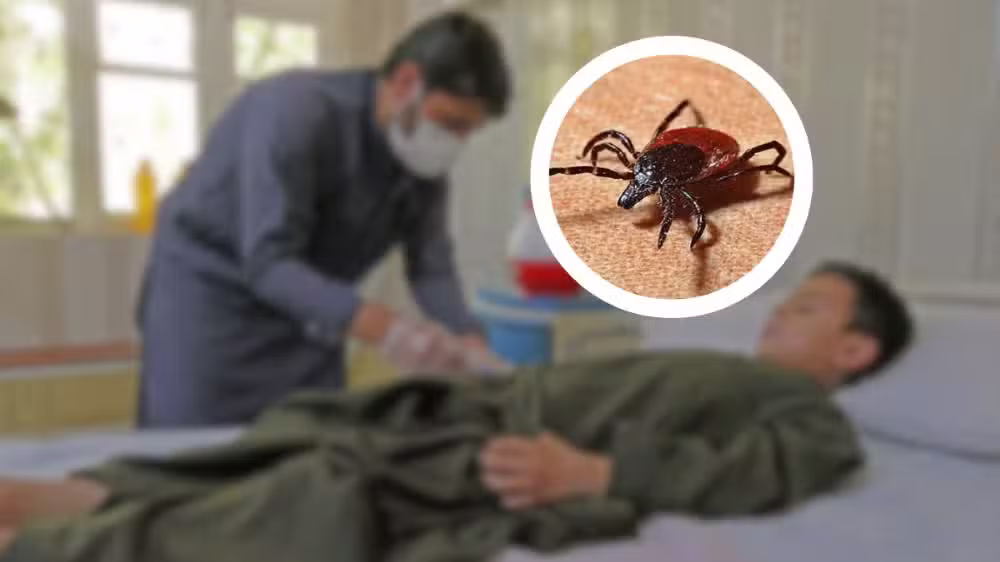 Karachi Reports First Congo Virus Case of 2024