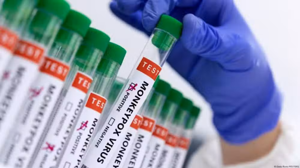 Second Monkeypox Case Confirmed in Pakistan in Two Days